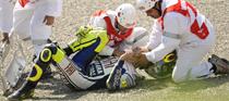 Rossi Breaks His Leg!